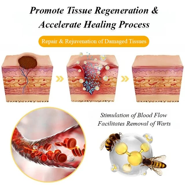 BOOMOON Bee Venom  Treatment Spray