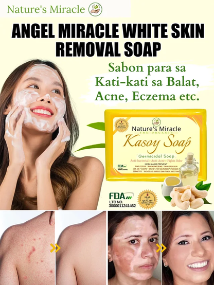 Angel Miracle White Spot Removal Soap