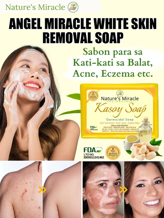 Angel Miracle White Spot Removal Soap