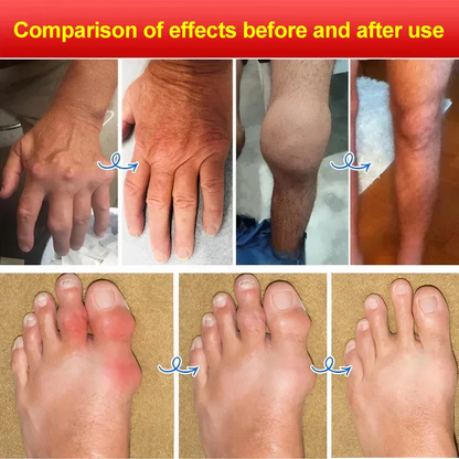 entilation buster sour wind plaster imported from Japan