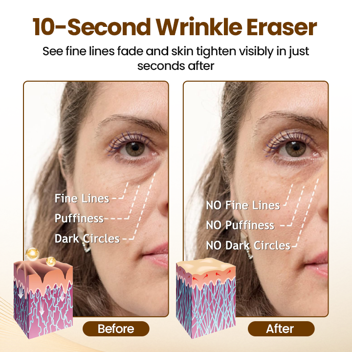 Liftora 10s Wrinkle Serum