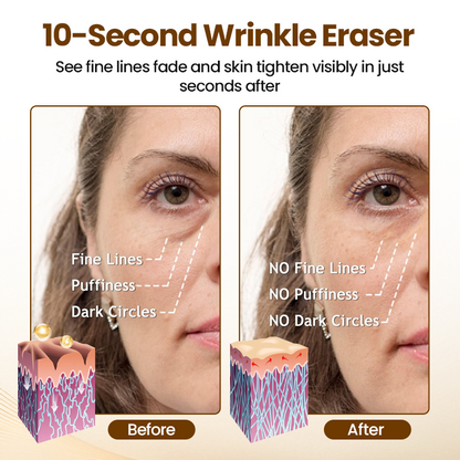 Liftora 10s Wrinkle Serum