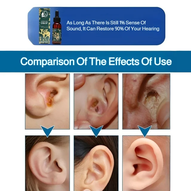 Dr.YuTiian ear drops gentle nourishing care ear discomfort care drops