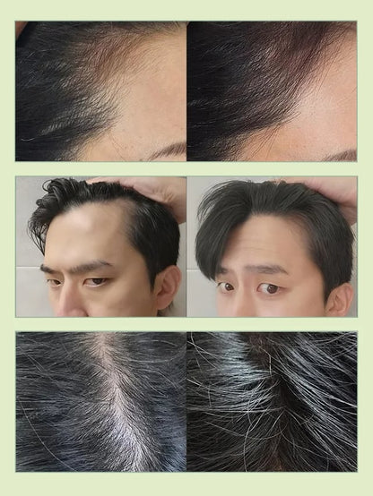 [Effective anti-hair loss] Rosemary amino acid anti-hair loss shampoo