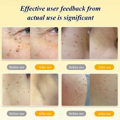 BOOMOON Bee Venom  Treatment Spray