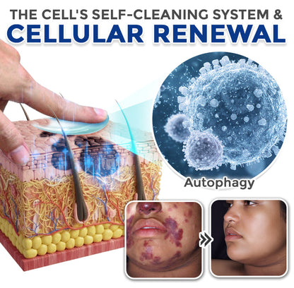 Spermidine Autophagy Comprehensive Cream ✨ (Treats Skin Tags, Warts, Eczema, Pigmentation, Keratosis)