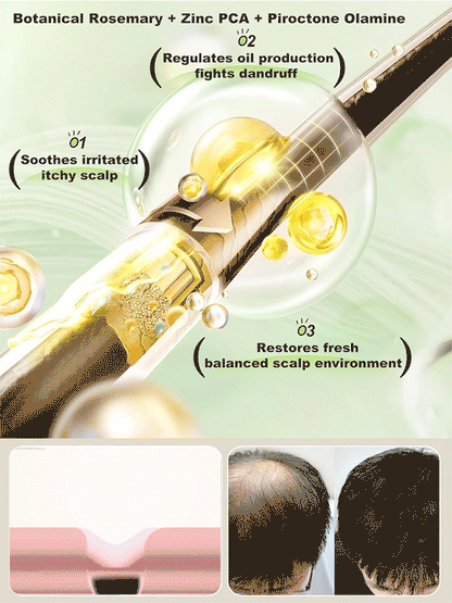 [Effective anti-hair loss] Rosemary amino acid anti-hair loss shampoo