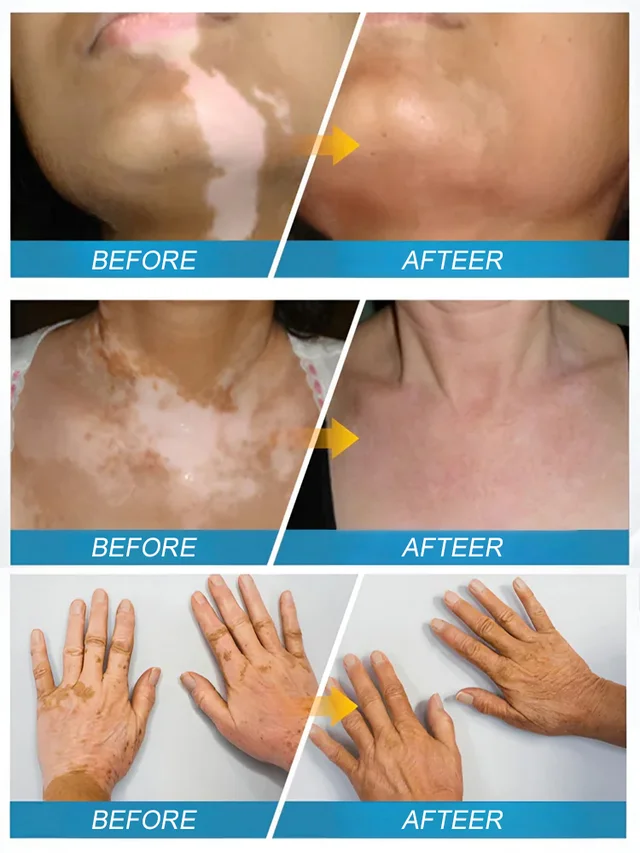 Angel Miracle White Spot Removal Soap