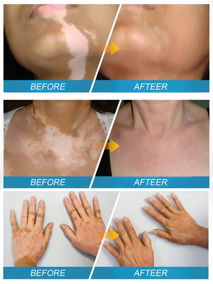 Angel Miracle White Spot Removal Soap