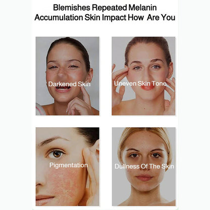 Radiant Skin Whitening & Spot Correcting Spray