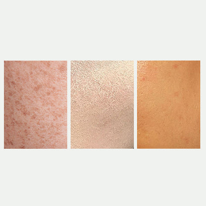 Radiant Skin Whitening & Spot Correcting Spray